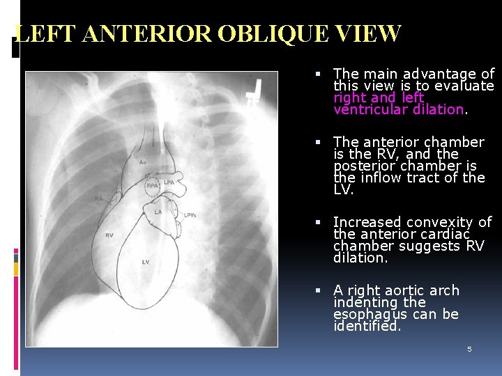 LEFT ANTERIOR OBLIQUE VIEW The main advantage of this view is to evaluate right
