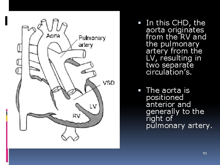  In this CHD, the aorta originates from the RV and the pulmonary artery