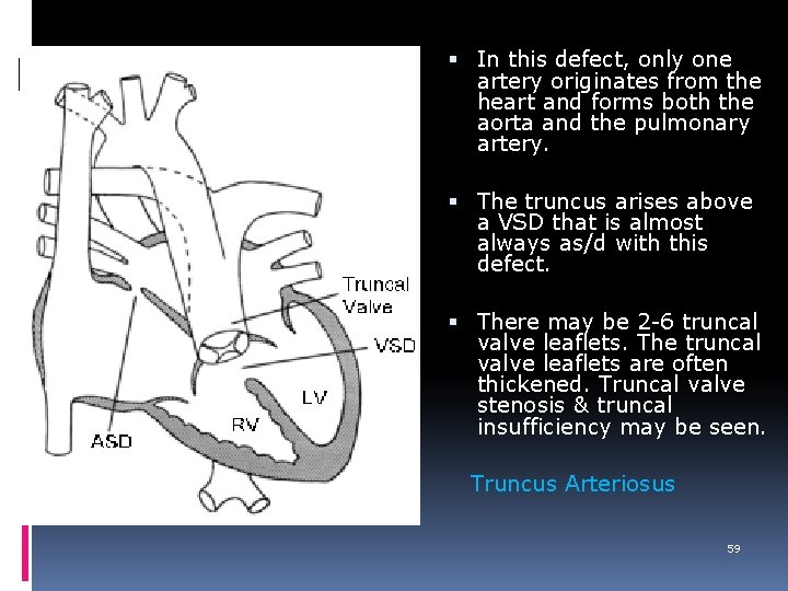  In this defect, only one artery originates from the heart and forms both