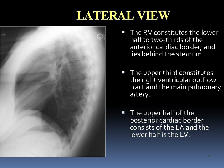 LATERAL VIEW The RV constitutes the lower half to two-thirds of the anterior cardiac