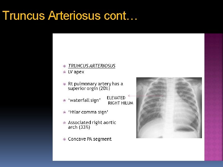 Truncus Arteriosus cont… 61 