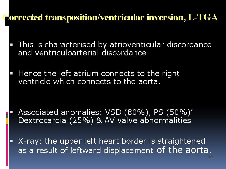 Corrected transposition/ventricular inversion, L-TGA This is characterised by atrioventicular discordance and ventriculoarterial discordance Hence