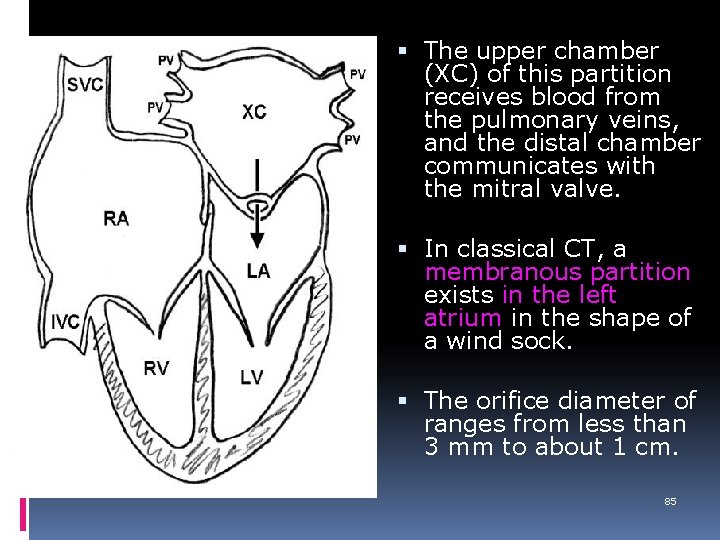  The upper chamber (XC) of this partition receives blood from the pulmonary veins,