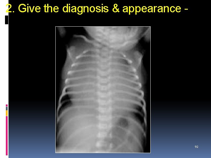 2. Give the diagnosis & appearance - 92 