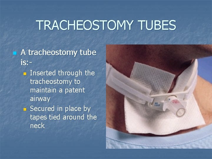 TRACHEOSTOMY TUBES n A tracheostomy tube is: n n Inserted through the tracheostomy to TRACHEOSTOMY TUBES n A tracheostomy tube is: n n Inserted through the tracheostomy to