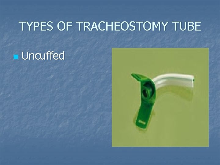 TYPES OF TRACHEOSTOMY TUBE n Uncuffed TYPES OF TRACHEOSTOMY TUBE n Uncuffed