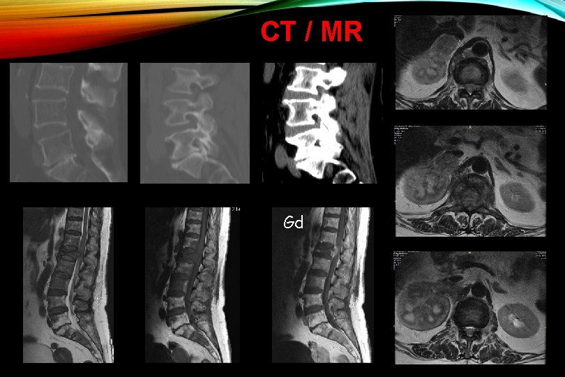 CT / MR Gd 