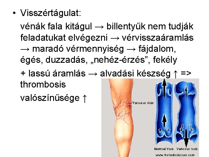  • Visszértágulat: vénák fala kitágul → billentyűk nem tudják feladatukat elvégezni → vérvisszaáramlás