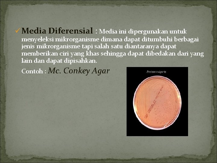 ü Media Diferensial : Media ini dipergunakan untuk menyeleksi mikrorganisme dimana dapat ditumbuhi berbagai