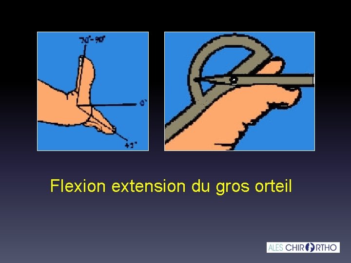 Flexion extension du gros orteil 