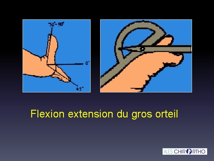 Flexion extension du gros orteil Flexion extension du gros orteil