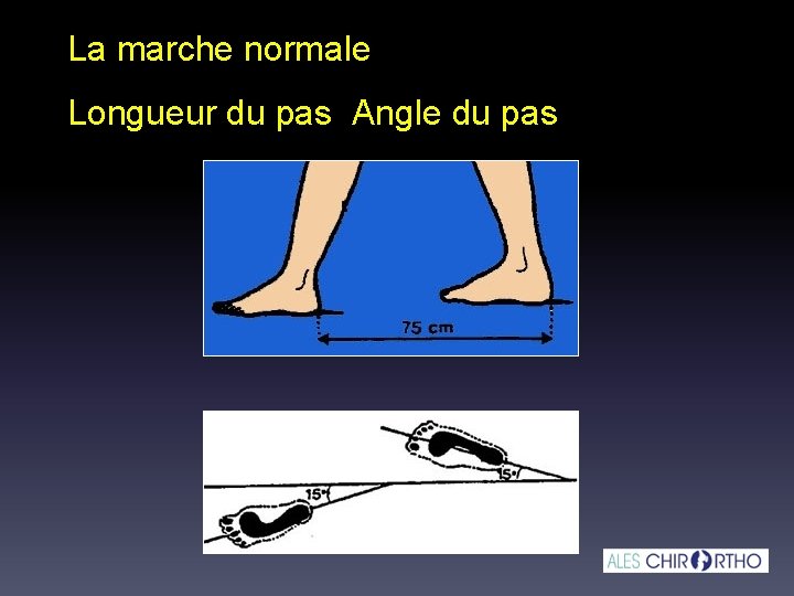 La marche normale Longueur du pas Angle du pas La marche normale Longueur du pas Angle du pas