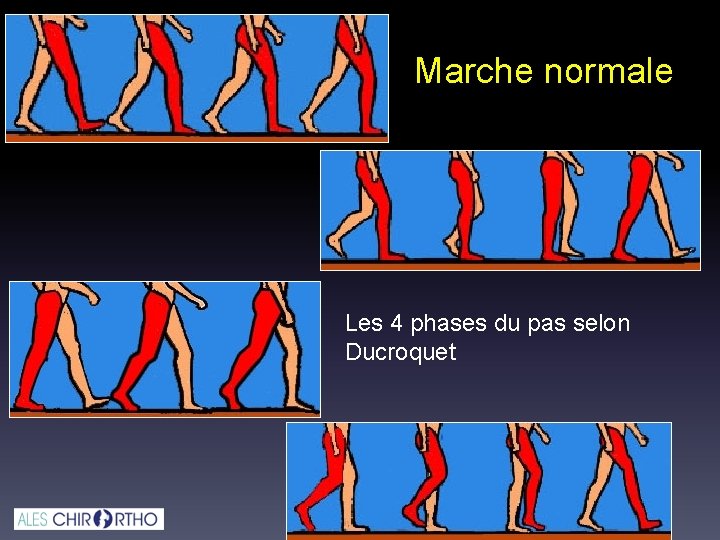 Marche normale Les 4 phases du pas selon Ducroquet Marche normale Les 4 phases du pas selon Ducroquet