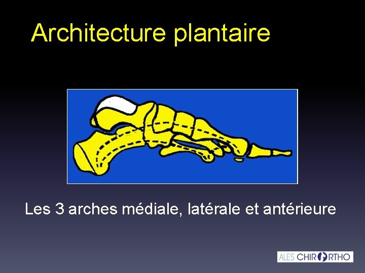 Architecture plantaire Les 3 arches médiale, latérale et antérieure 