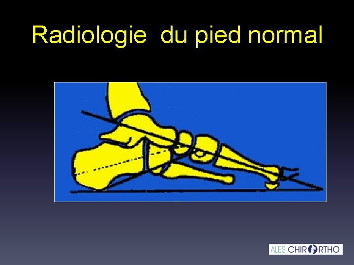 Radiologie du pied normal 