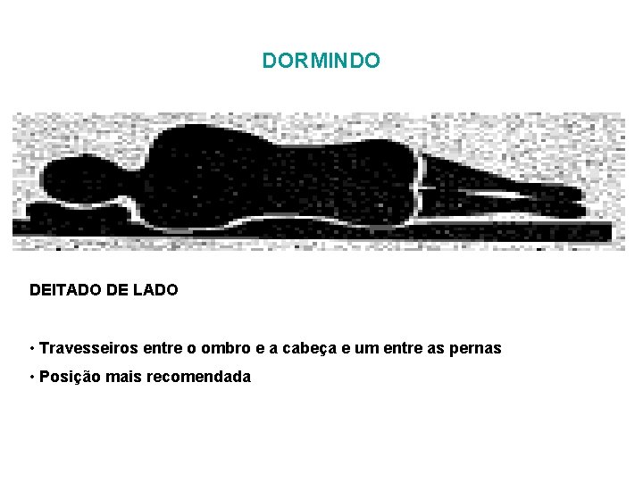 DORMINDO DEITADO DE LADO • Travesseiros entre o ombro e a cabeça e um DORMINDO DEITADO DE LADO • Travesseiros entre o ombro e a cabeça e um