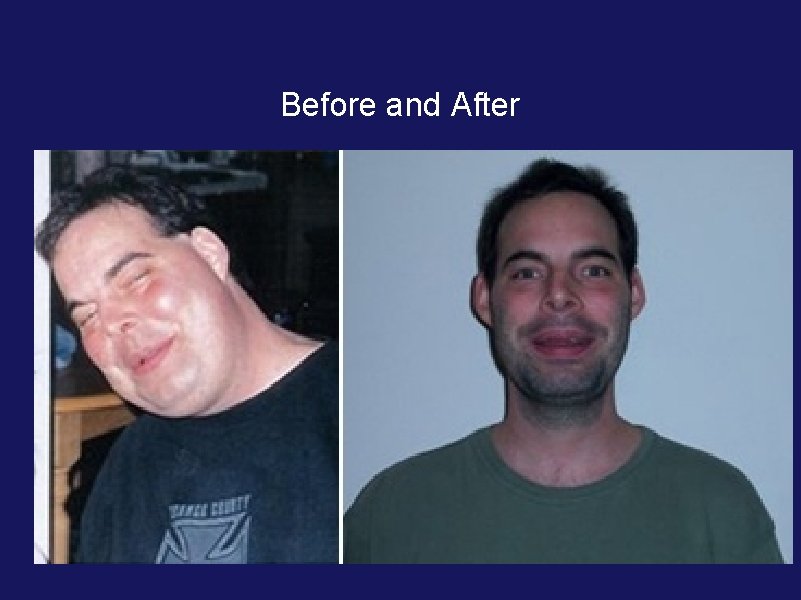 Before and After Before and After