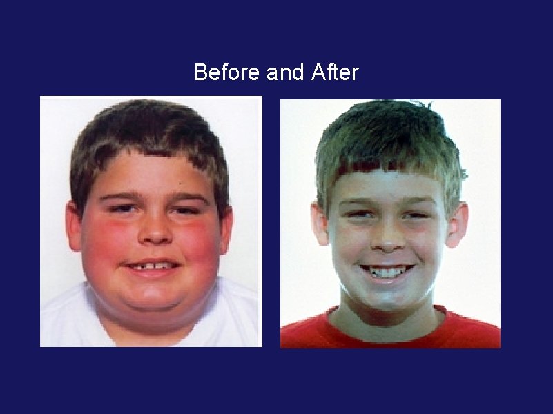 Before and After Before and After