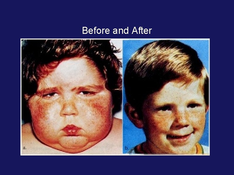 Before and After Before and After