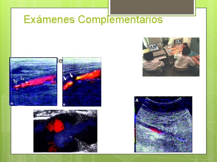 Exámenes Complementarios Ecodoppler Color: 