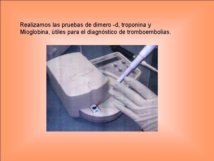 Realizamos las pruebas de dimero -d, troponina y Mioglobina, útiles para el diagnóstico de