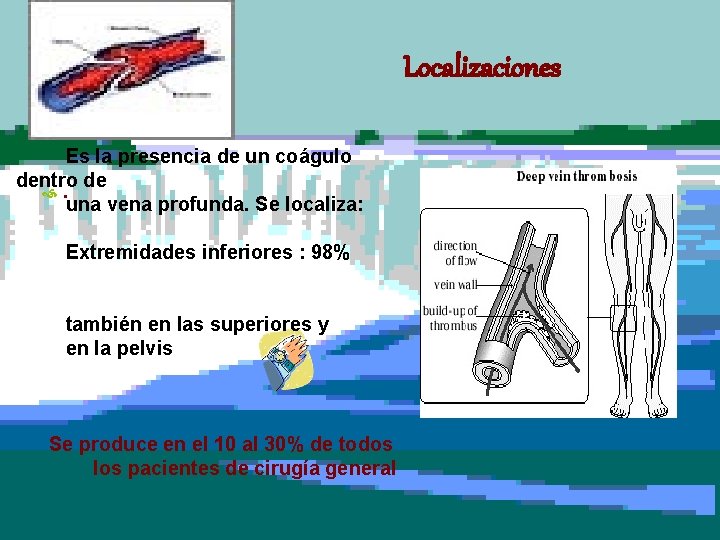 Localizaciones Es la presencia de un coágulo dentro de . una vena profunda. Se