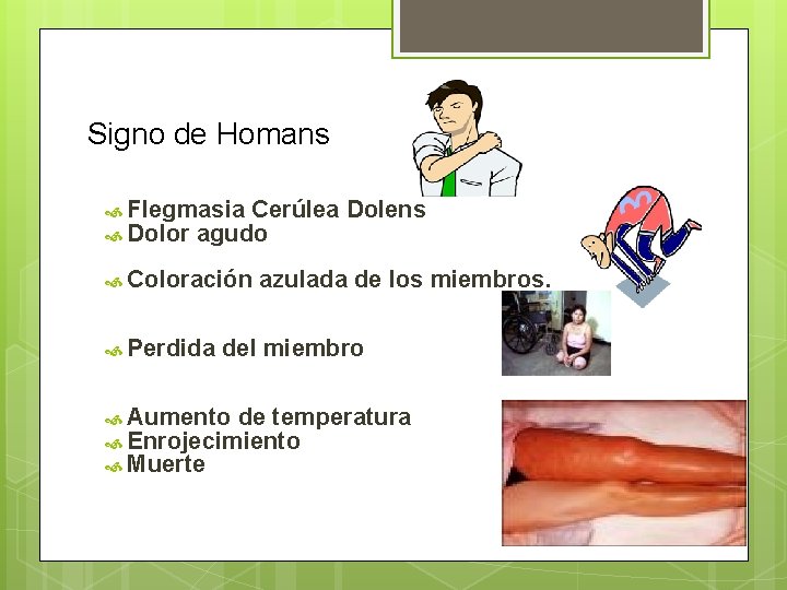 Signo de Homans Flegmasia Cerúlea Dolor agudo Coloración Perdida Dolens azulada de los miembros.