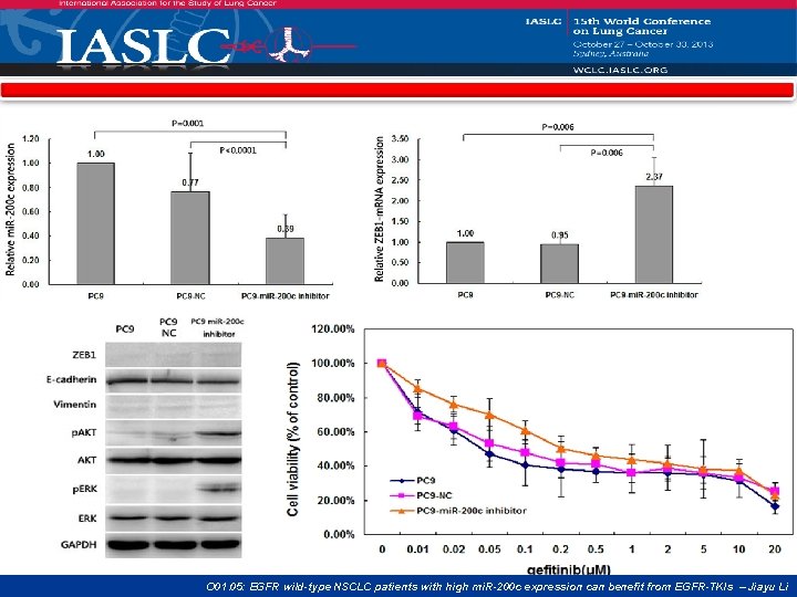 O 01. 05: EGFR wild-type NSCLC patients with high. Presentation mi. R-200 c expression
