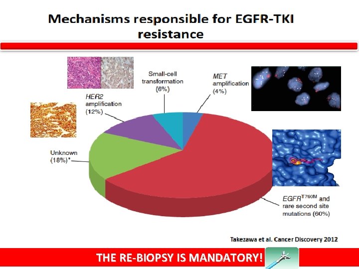 THE RE-BIOPSY IS MANDATORY! 