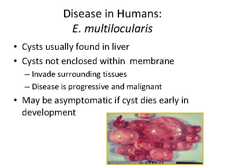 Disease in Humans: E. multilocularis • Cysts usually found in liver • Cysts not