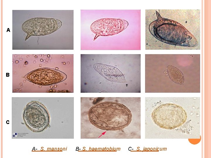 A B C A- S. mansoni B- S. haematobium C- S. japonicum 