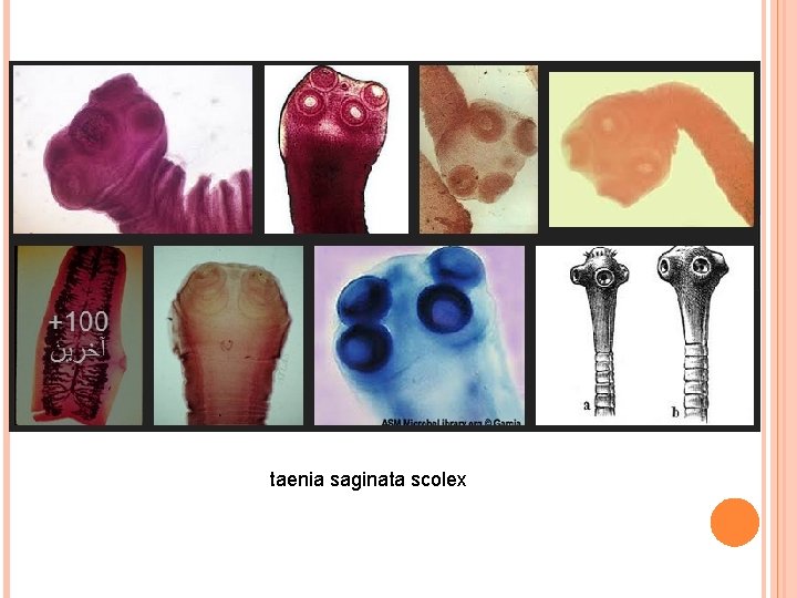 taenia saginata scolex 
