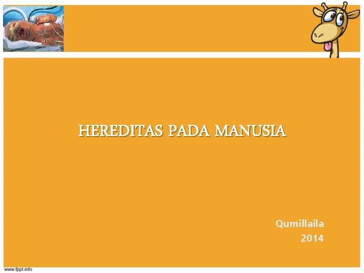HEREDITAS PADA MANUSIA Qumillaila 2014 