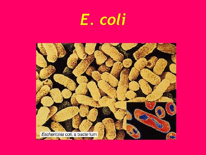 E. coli 