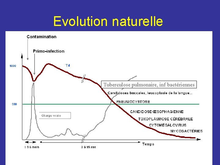 Evolution naturelle Tuberculose pulmonaire, inf bactériennes 