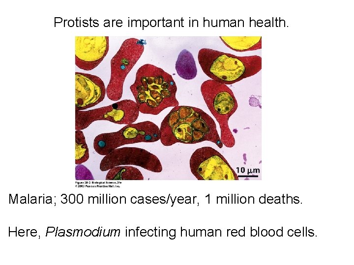 Protists are important in human health. Malaria; 300 million cases/year, 1 million deaths. Here,