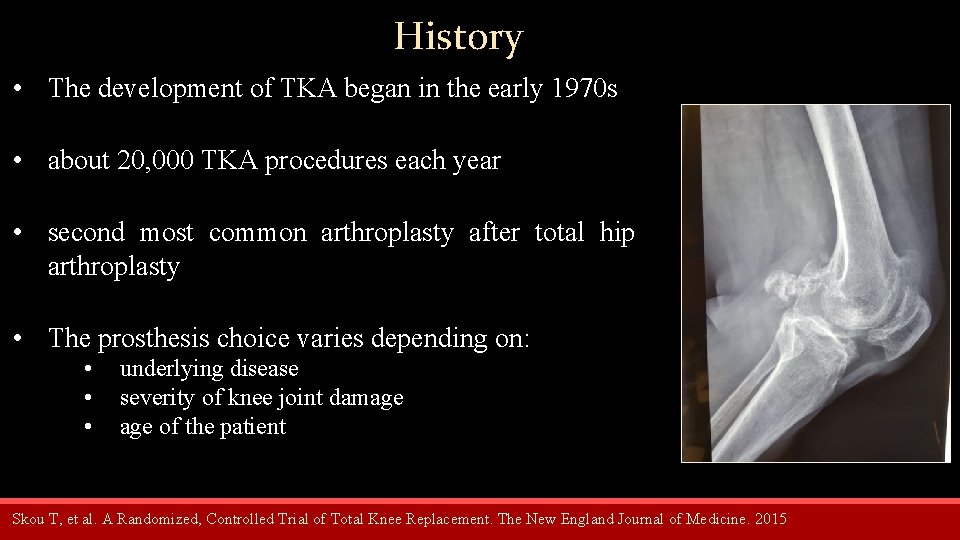 History • The development of TKA began in the early 1970 s • about