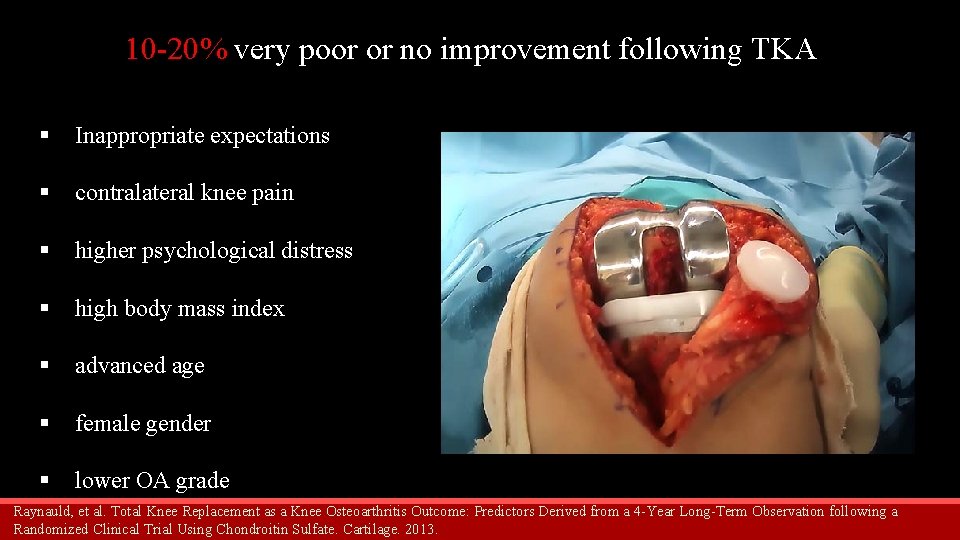 10 -20% very poor or no improvement following TKA § Inappropriate expectations § contralateral