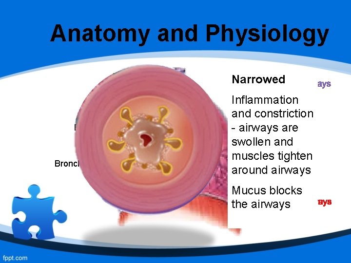 Anatomy and Physiology Trachea Bronchioles Narrowed Healthy Inflammation Airways are and constriction clear and