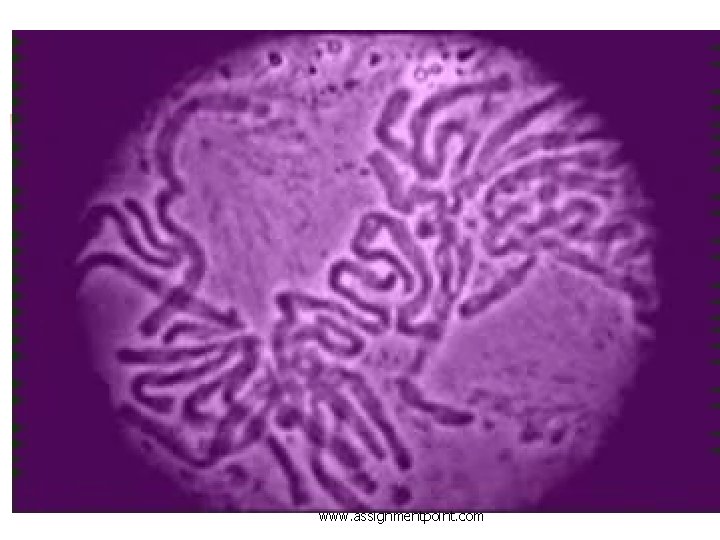 Prophase- the nuclear membrane breaks down. The double stranded chromosomes are able to move
