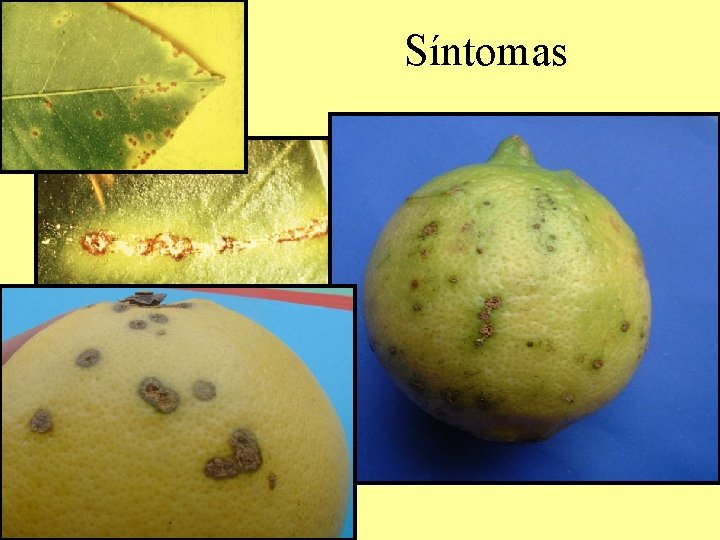 Síntomas Síntomas