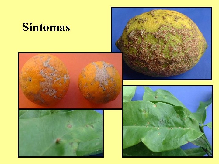 Síntomas Síntomas