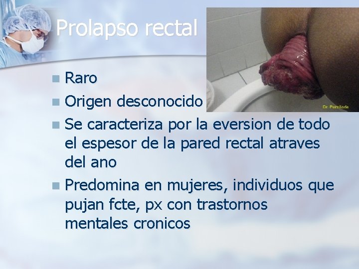 Prolapso rectal Raro n Origen desconocido n Se caracteriza por la eversion de todo