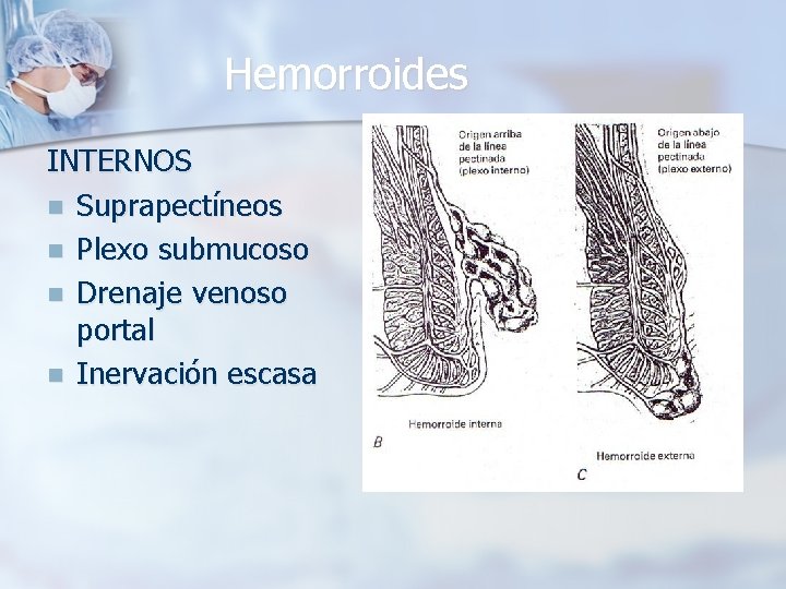 Hemorroides INTERNOS n Suprapectíneos n Plexo submucoso n Drenaje venoso portal n Inervación escasa
