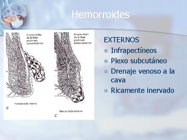 Hemorroides EXTERNOS n Infrapectíneos n Plexo subcutáneo n Drenaje venoso a la cava n