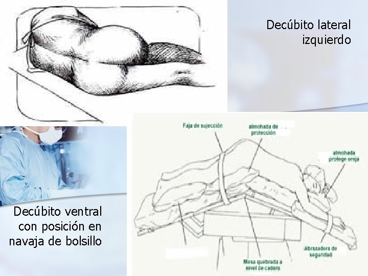 Decúbito lateral izquierdo Decúbito ventral con posición en navaja de bolsillo 