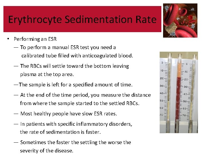 Erythrocyte Sedimentation Rate • Performing an ESR — To perform a manual ESR test