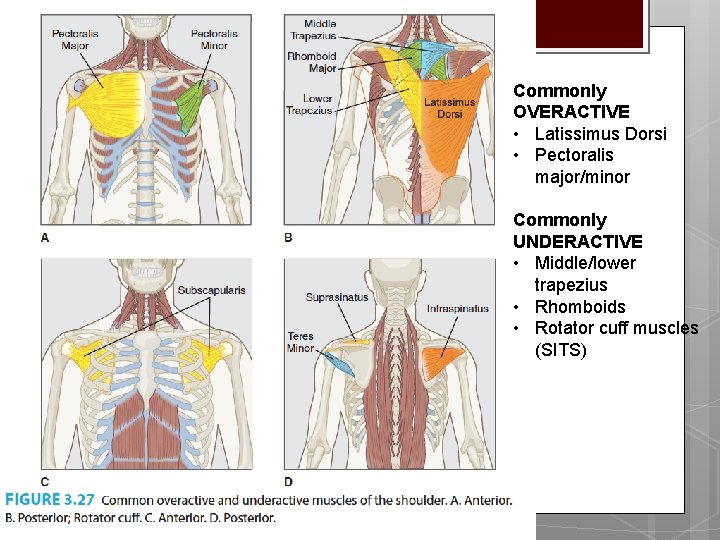 Commonly OVERACTIVE • Latissimus Dorsi • Pectoralis major/minor Commonly UNDERACTIVE • Middle/lower trapezius •