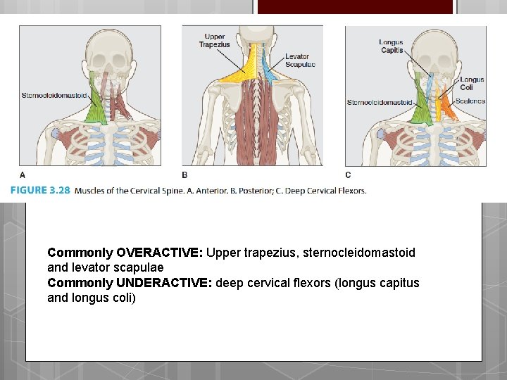 Commonly OVERACTIVE: Upper trapezius, sternocleidomastoid and levator scapulae Commonly UNDERACTIVE: deep cervical flexors (longus