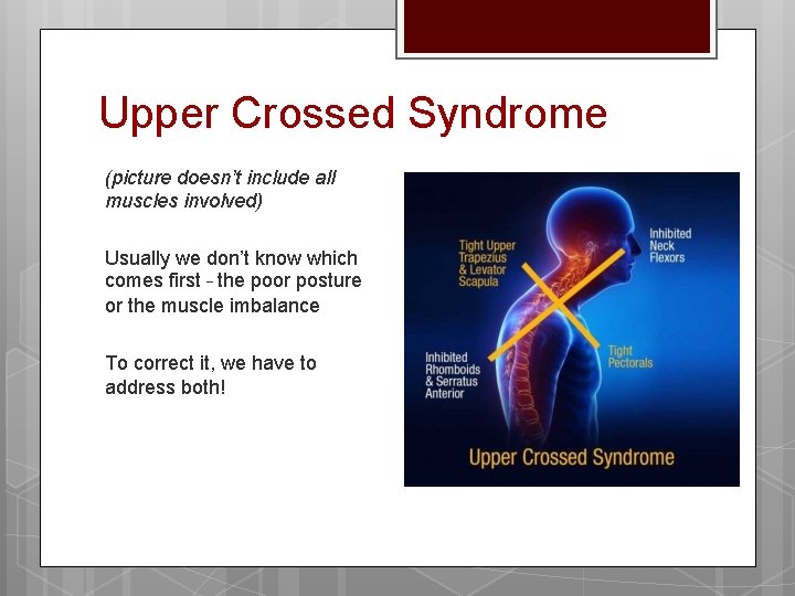 Upper Crossed Syndrome (picture doesn’t include all muscles involved) Usually we don’t know which